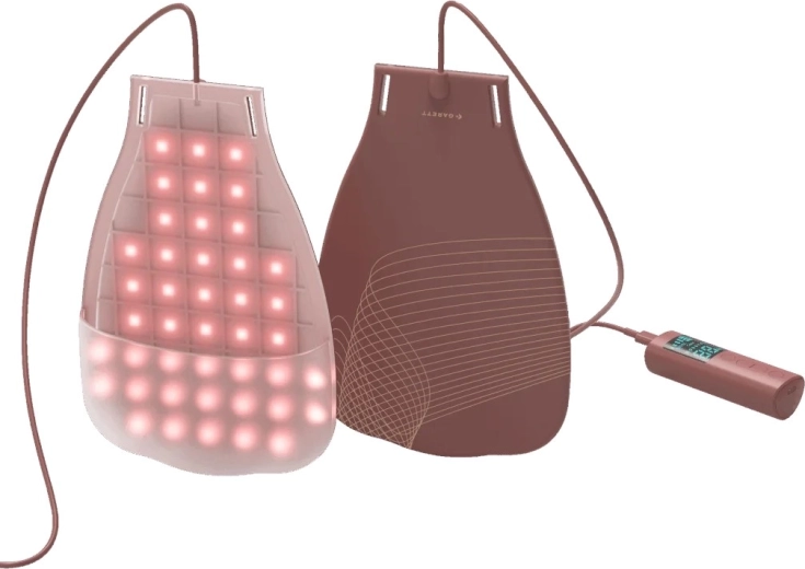 150 de LED-uri pentru acoperire uniformă