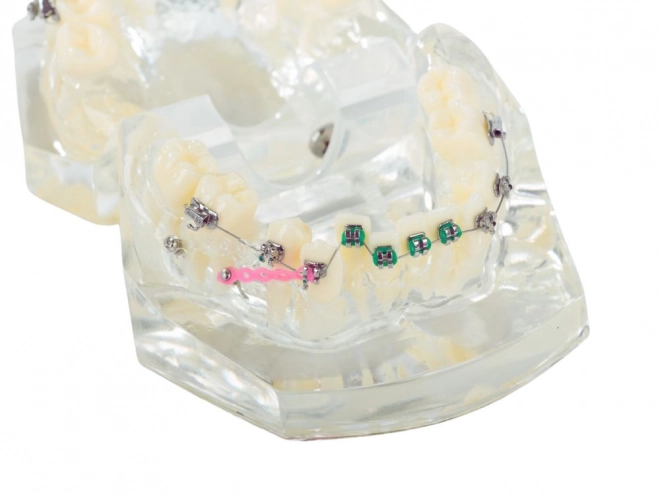 Model dentar pentru ortodonție