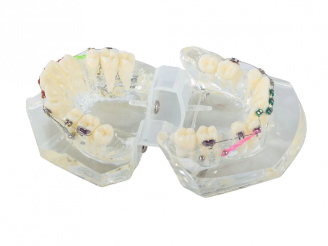 Model dentar pentru ortodonție