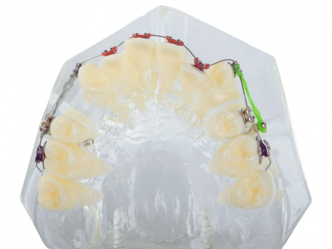 Model dentar pentru ortodonție