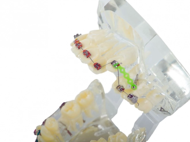 Model dentar pentru ortodonție